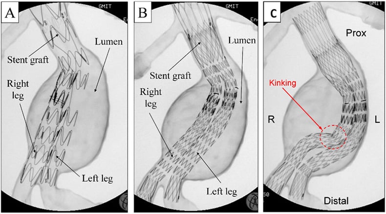 Deployment test of two different stent-grafts under fluoroscopy